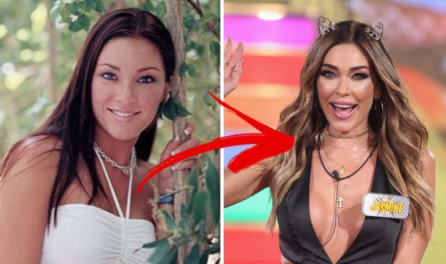 Jasmine Waltz before and after surgery: Doctor speaks on Celebrity ...